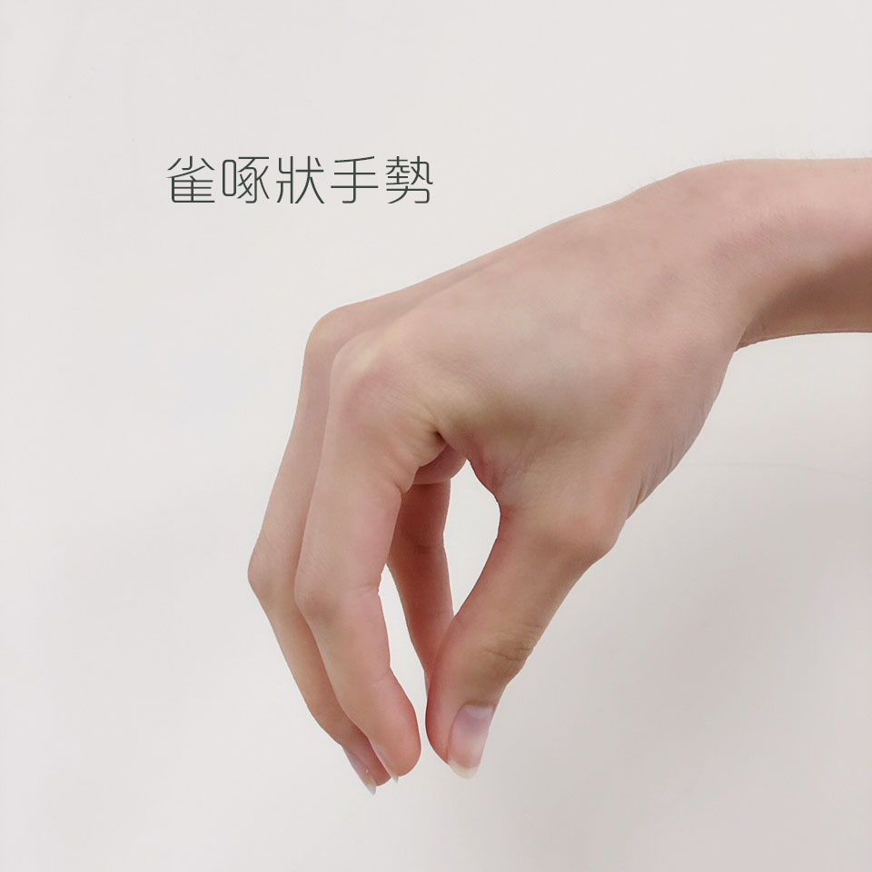 考試穴位按摩-雀啄狀