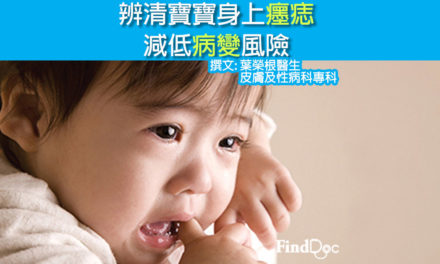 辨清寶寶身上癦痣 減低病變風險